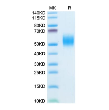 Tris-Bis PAGE - Recombinant Mouse CD332 Protein (C-terminal His Tag) (A331597) - Antibodies.com