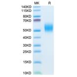 Tris-Bis PAGE - Recombinant Mouse CD332 Protein (C-terminal His Tag) (A331597) - Antibodies.com