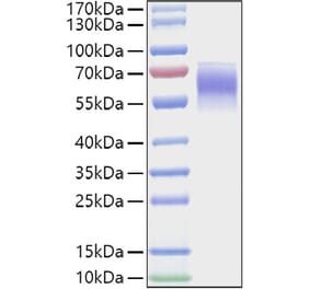 SDS-PAGE - Recombinant Mouse FGFR4 Protein (C-terminal His Tag) (A331598) - Antibodies.com