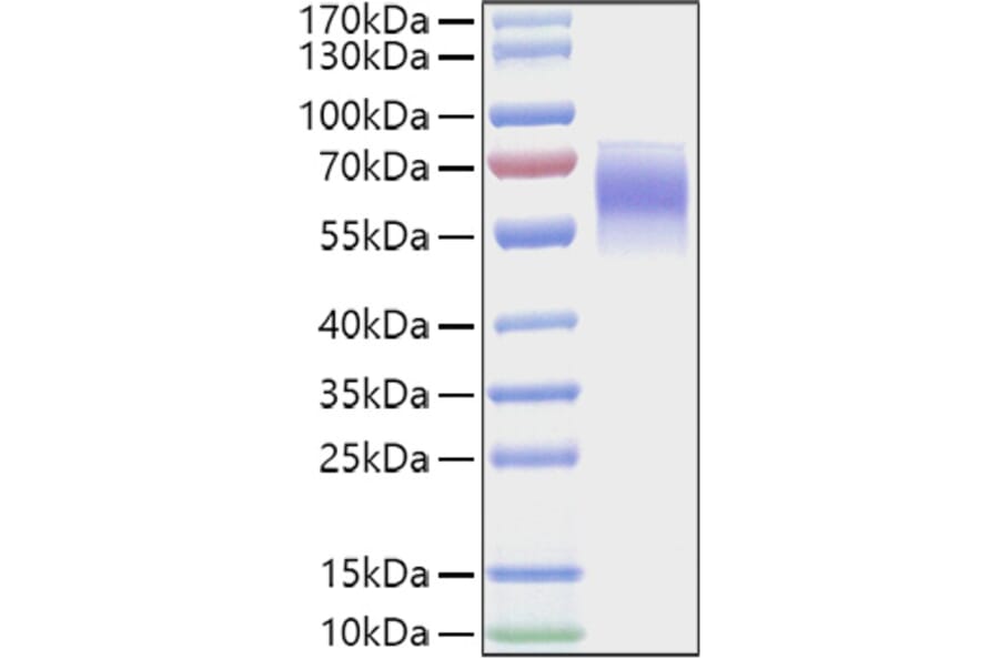 SDS-PAGE - Recombinant Mouse FGFR4 Protein (C-terminal His Tag) (A331598) - Antibodies.com