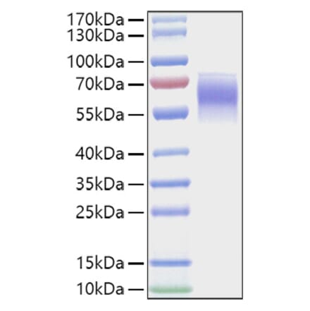 SDS-PAGE - Recombinant Mouse FGFR4 Protein (C-terminal His Tag) (A331598) - Antibodies.com
