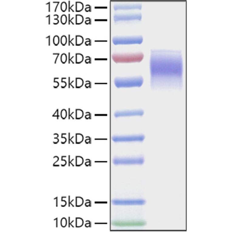 SDS-PAGE - Recombinant Mouse FGFR4 Protein (C-terminal His Tag) (A331598) - Antibodies.com