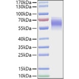 SDS-PAGE - Recombinant Mouse FGFR4 Protein (C-terminal His Tag) (A331598) - Antibodies.com