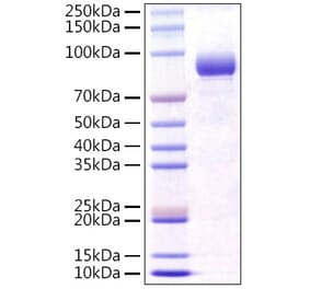 SDS-PAGE - Recombinant Mouse FGFR4 Protein (C-terminal Human Fc Tag) (A331599) - Antibodies.com