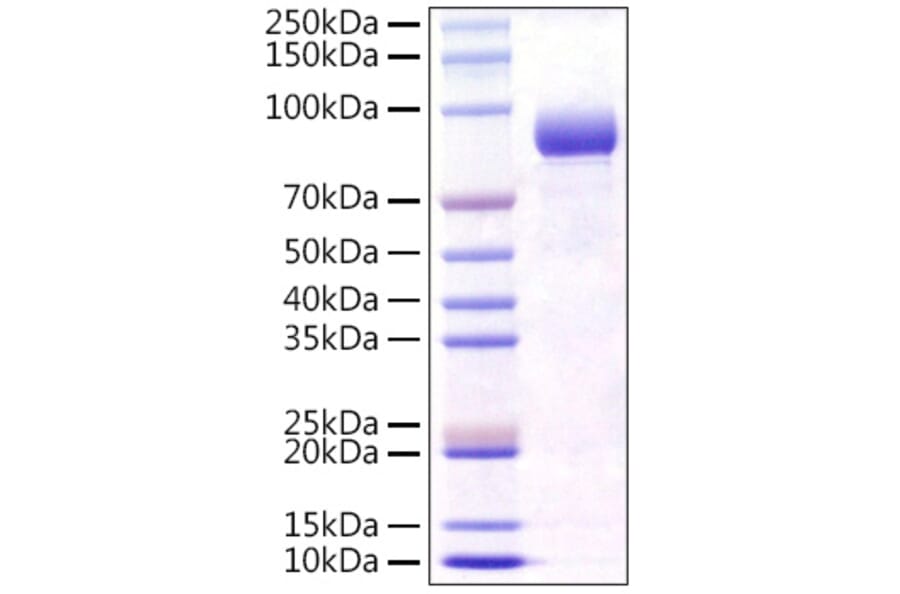 SDS-PAGE - Recombinant Mouse FGFR4 Protein (C-terminal Human Fc Tag) (A331599) - Antibodies.com