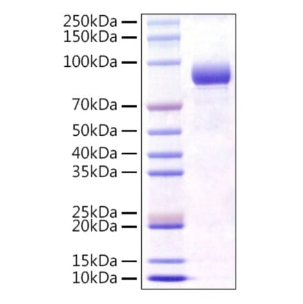 SDS-PAGE - Recombinant Mouse FGFR4 Protein (C-terminal Human Fc Tag) (A331599) - Antibodies.com