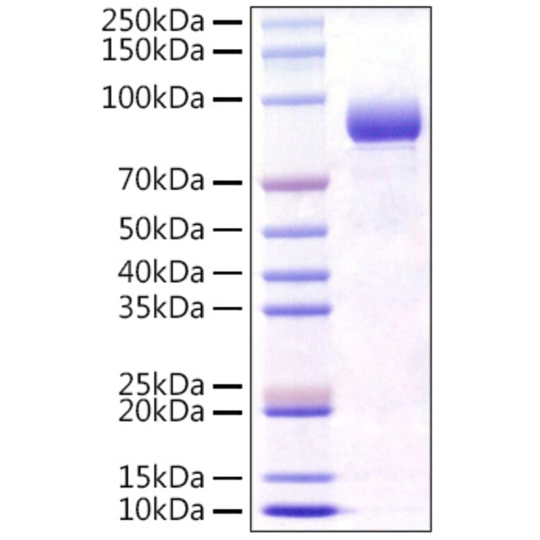 SDS-PAGE - Recombinant Mouse FGFR4 Protein (C-terminal Human Fc Tag) (A331599) - Antibodies.com