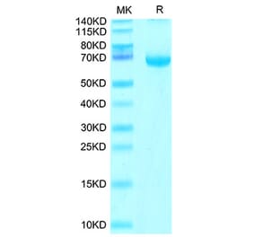 Tris-Bis PAGE - Recombinant Cynomolgus macaque FGL1 Protein (N-terminal Human Fc Tag) (A331600) - Antibodies.com