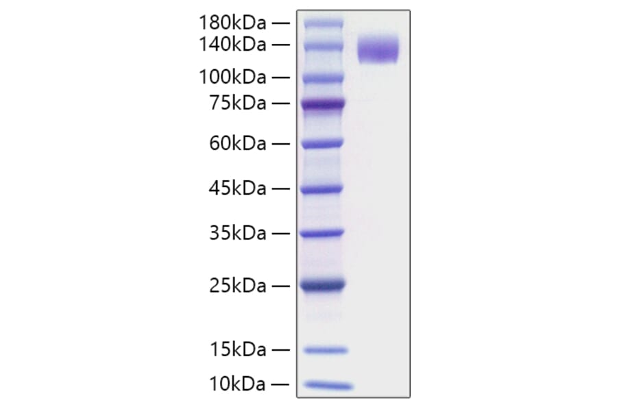 SDS-PAGE - Recombinant Mouse Flt3 Protein (C-terminal Human Fc Tag) (A331601) - Antibodies.com