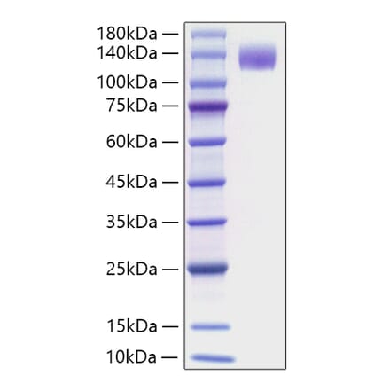 SDS-PAGE - Recombinant Mouse Flt3 Protein (C-terminal Human Fc Tag) (A331601) - Antibodies.com