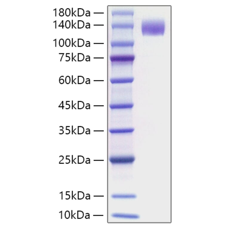SDS-PAGE - Recombinant Mouse Flt3 Protein (C-terminal Human Fc Tag) (A331601) - Antibodies.com
