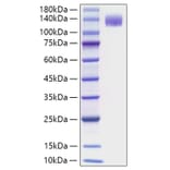 SDS-PAGE - Recombinant Mouse Flt3 Protein (C-terminal Human Fc Tag) (A331601) - Antibodies.com
