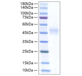 SDS-PAGE - Recombinant Rat Follistatin Protein (C-terminal His Tag) (A331602) - Antibodies.com