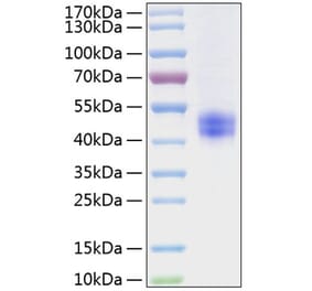 SDS-PAGE - Recombinant Mouse Follistatin Protein (C-terminal His Tag) (A331603) - Antibodies.com