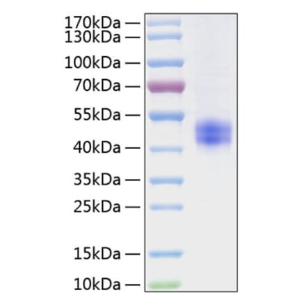 SDS-PAGE - Recombinant Mouse Follistatin Protein (C-terminal His Tag) (A331603) - Antibodies.com