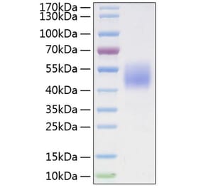 SDS-PAGE - Recombinant Mouse FSTL1 Protein (C-terminal His Tag) (A331604) - Antibodies.com