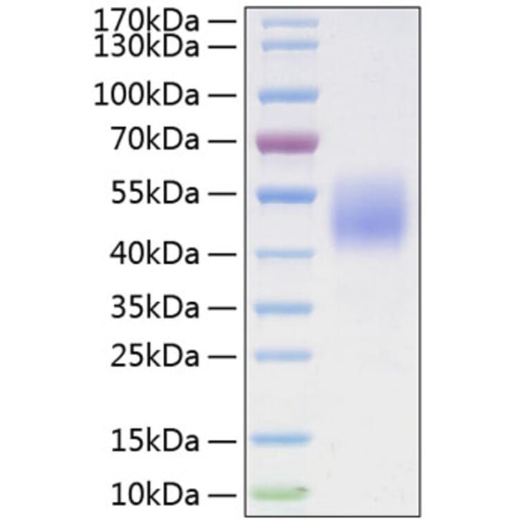 SDS-PAGE - Recombinant Mouse FSTL1 Protein (C-terminal His Tag) (A331604) - Antibodies.com