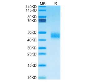 SDS-PAGE - Recombinant Mouse Galectin 3 Protein (C-terminal His Tag) (A331606) - Antibodies.com