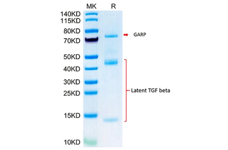 Tris-Bis PAGE - Recombinant Mouse Latent TGF beta 1 Protein (Biotin) (N-terminal His and Avi Tag) (A331608) - Antibodies.com