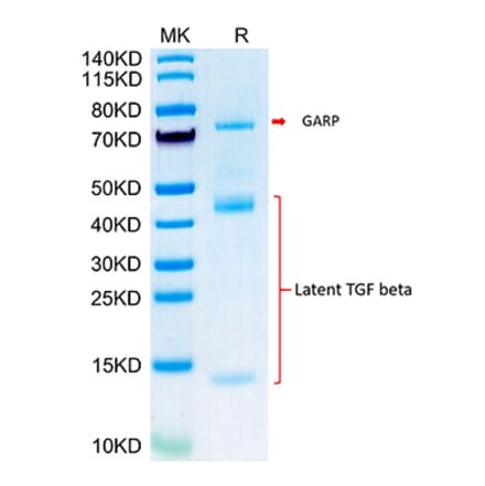 Tris-Bis PAGE - Recombinant Mouse Latent TGF beta 1 Protein (Biotin) (N-terminal His and Avi Tag) (A331608) - Antibodies.com