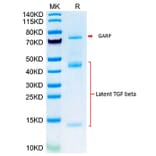 Tris-Bis PAGE - Recombinant Mouse Latent TGF beta 1 Protein (Biotin) (N-terminal His and Avi Tag) (A331608) - Antibodies.com