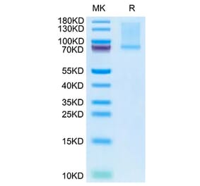 SDS-PAGE - Recombinant Mouse GAS6 Protein (C-terminal His Tag) (A331609) - Antibodies.com