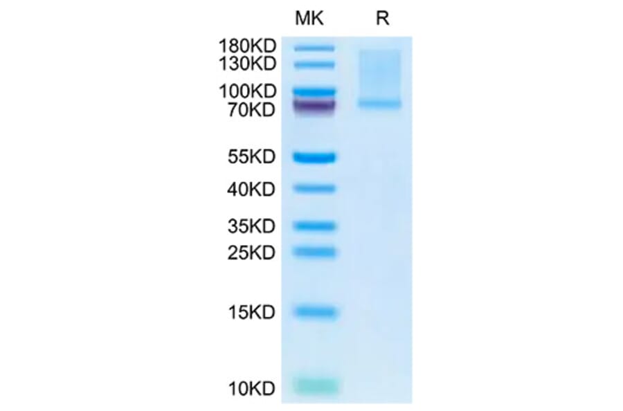SDS-PAGE - Recombinant Mouse GAS6 Protein (C-terminal His Tag) (A331609) - Antibodies.com