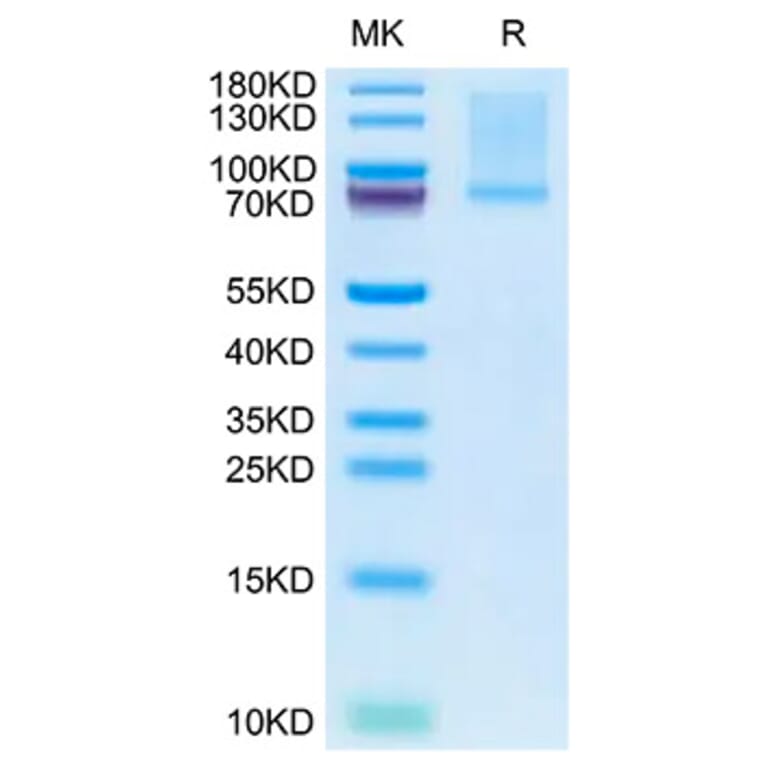 SDS-PAGE - Recombinant Mouse GAS6 Protein (C-terminal His Tag) (A331609) - Antibodies.com