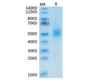 Tris-Bis PAGE - Recombinant Mouse GFRAL Protein (N-terminal His and Avi Tag) (A331610) - Antibodies.com