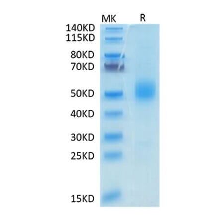 Tris-Bis PAGE - Recombinant Mouse GFRAL Protein (N-terminal His and Avi Tag) (A331610) - Antibodies.com