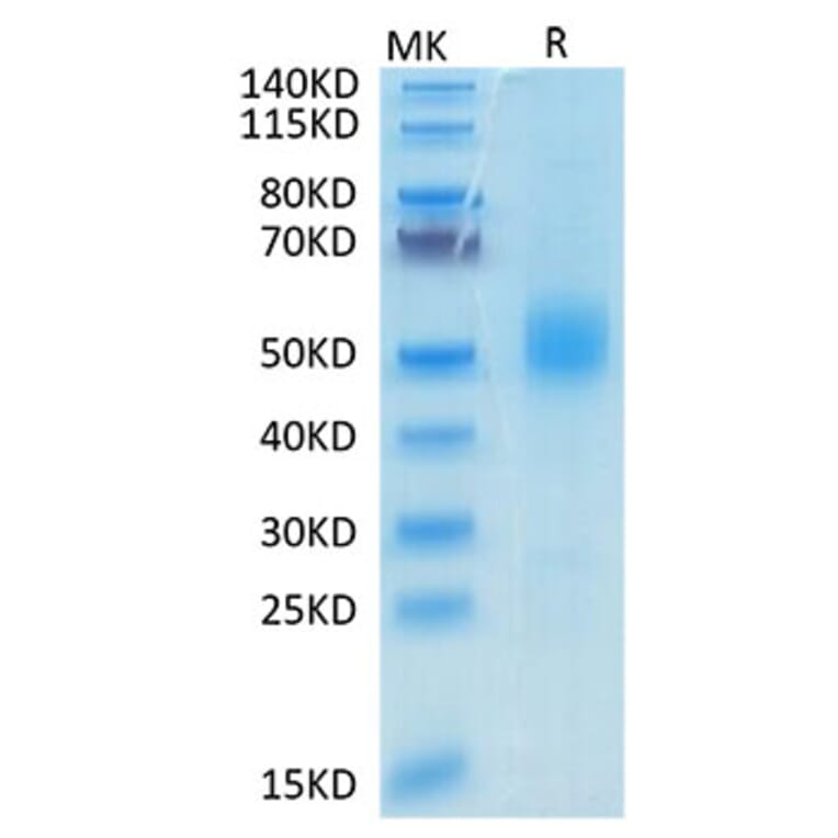 Tris-Bis PAGE - Recombinant Mouse GFRAL Protein (N-terminal His and Avi Tag) (A331610) - Antibodies.com