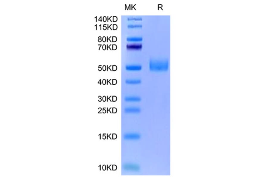 Tris-Bis PAGE - Recombinant Mouse GFRAL Protein (Biotin) (N-terminal His and Avi Tag) (A331611) - Antibodies.com