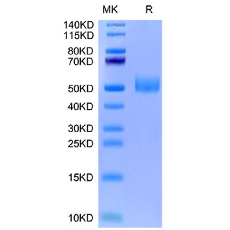 Tris-Bis PAGE - Recombinant Mouse GFRAL Protein (Biotin) (N-terminal His and Avi Tag) (A331611) - Antibodies.com