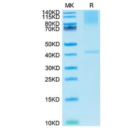 Tris-Bis PAGE - Recombinant Cynomolgus macaque Glypican 3 Protein (C-terminal His Tag) (A331613) - Antibodies.com