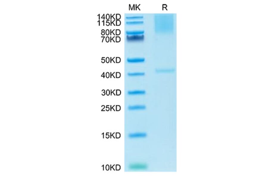 Tris-Bis PAGE - Recombinant Cynomolgus macaque Glypican 3 Protein (C-terminal His Tag) (A331613) - Antibodies.com