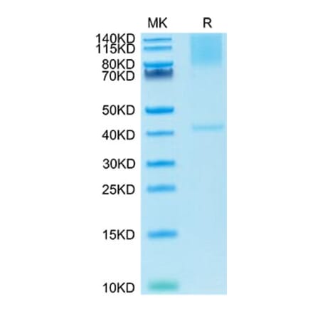 Tris-Bis PAGE - Recombinant Cynomolgus macaque Glypican 3 Protein (C-terminal His Tag) (A331613) - Antibodies.com