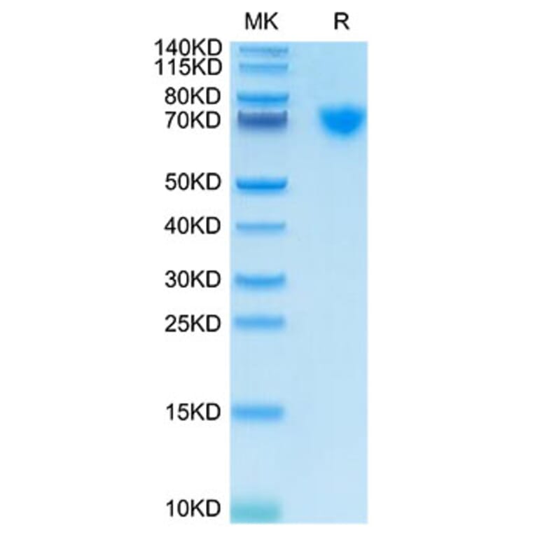 Tris-Bis PAGE - Recombinant Cynomolgus macaque GUCY2C Protein (C-terminal His Tag) (A331617) - Antibodies.com