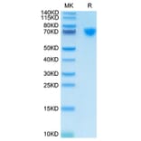 Tris-Bis PAGE - Recombinant Cynomolgus macaque GUCY2C Protein (C-terminal His Tag) (A331617) - Antibodies.com