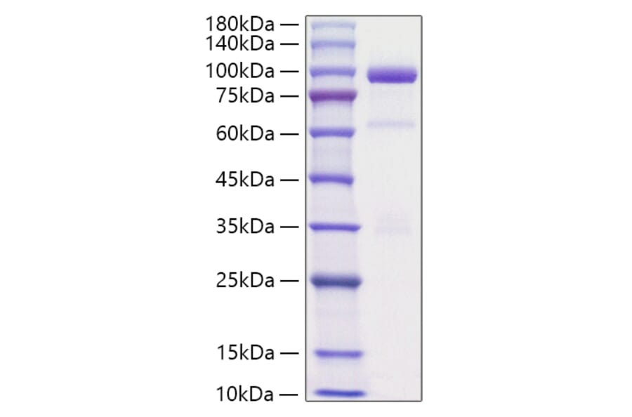 SDS-PAGE - Recombinant Rat HGF Protein (C-terminal His Tag) (A331619) - Antibodies.com