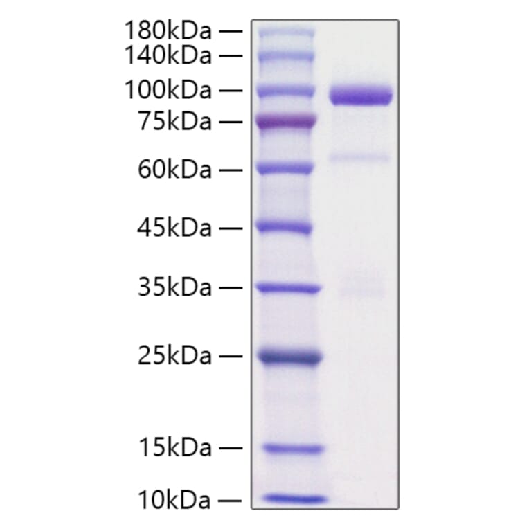 SDS-PAGE - Recombinant Rat HGF Protein (C-terminal His Tag) (A331619) - Antibodies.com