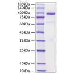 SDS-PAGE - Recombinant Rat HGF Protein (C-terminal His Tag) (A331619) - Antibodies.com