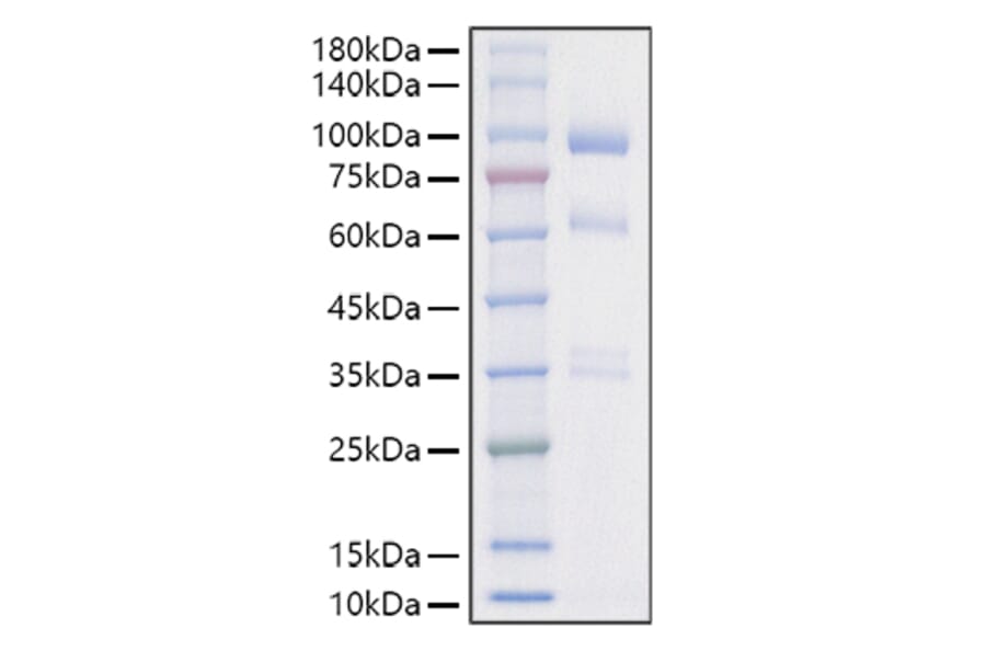 SDS-PAGE - Recombinant Mouse HGF Protein (C-terminal His Tag) (A331620) - Antibodies.com