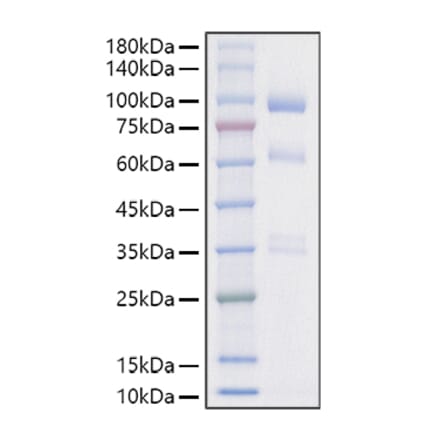 SDS-PAGE - Recombinant Mouse HGF Protein (C-terminal His Tag) (A331620) - Antibodies.com