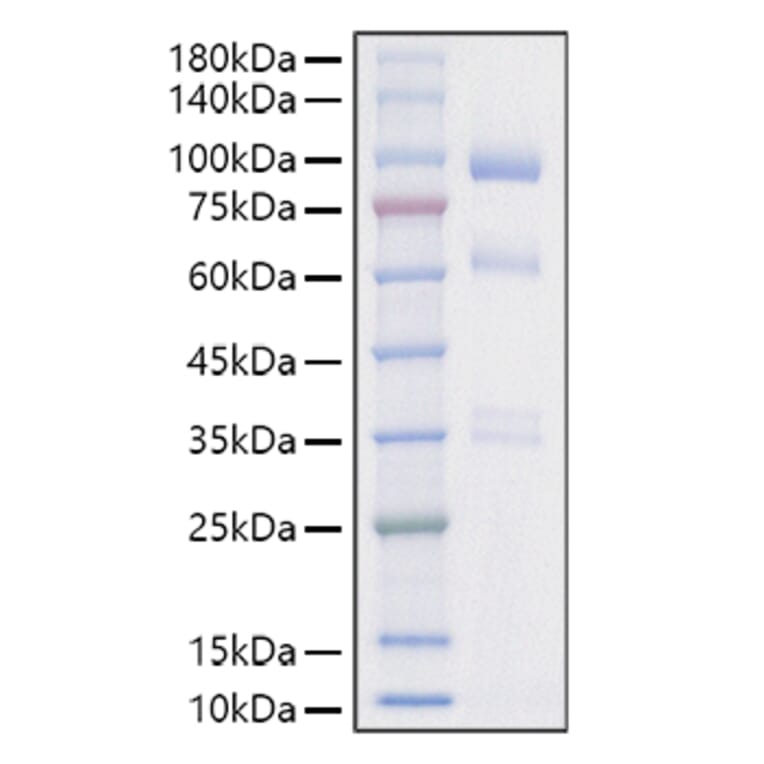 SDS-PAGE - Recombinant Mouse HGF Protein (C-terminal His Tag) (A331620) - Antibodies.com