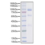 SDS-PAGE - Recombinant Mouse HGF Protein (C-terminal His Tag) (A331620) - Antibodies.com
