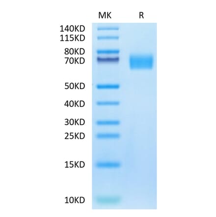Tris-Bis PAGE - Recombinant Human EGFR Protein (Biotin) (C-terminal His and Avi Tag) (A331621) - Antibodies.com