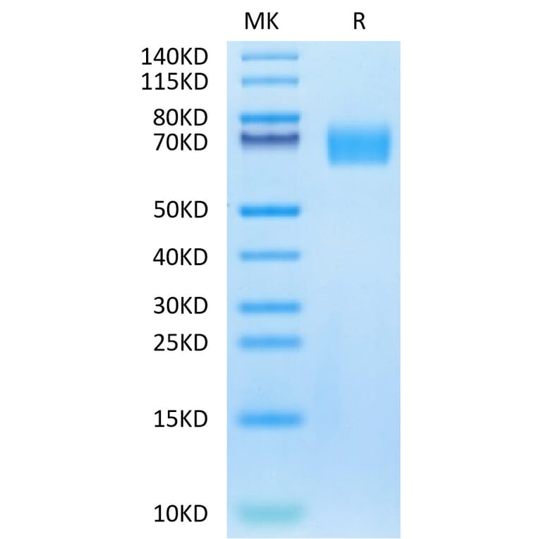 Tris-Bis PAGE - Recombinant Human EGFR Protein (Biotin) (C-terminal His and Avi Tag) (A331621) - Antibodies.com