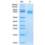Tris-Bis PAGE - Recombinant Human EGFR Protein (Biotin) (C-terminal His and Avi Tag) (A331621) - Antibodies.com