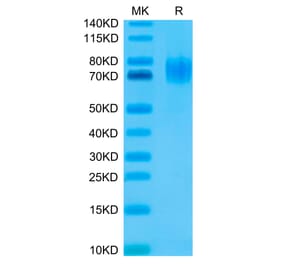 Tris-Bis PAGE - Recombinant Human EGFR Protein (C-terminal His and Avi Tag) (A331622) - Antibodies.com