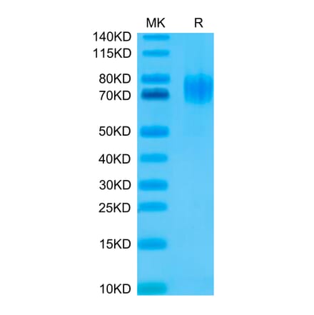 Tris-Bis PAGE - Recombinant Human EGFR Protein (C-terminal His and Avi Tag) (A331622) - Antibodies.com